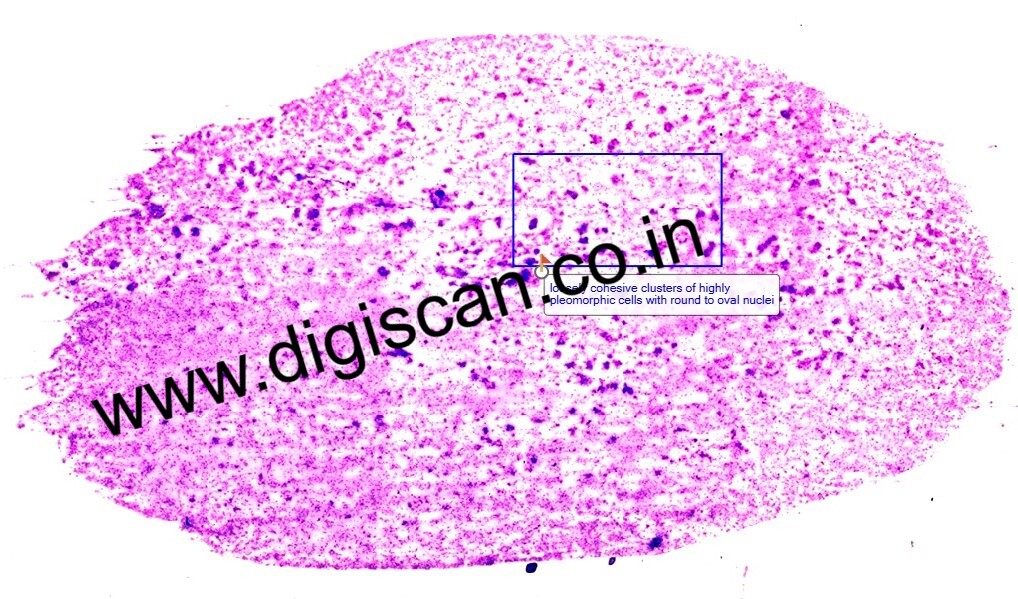 Fine Needle Aspiration Cytology (FNAC) Digital Slides Set