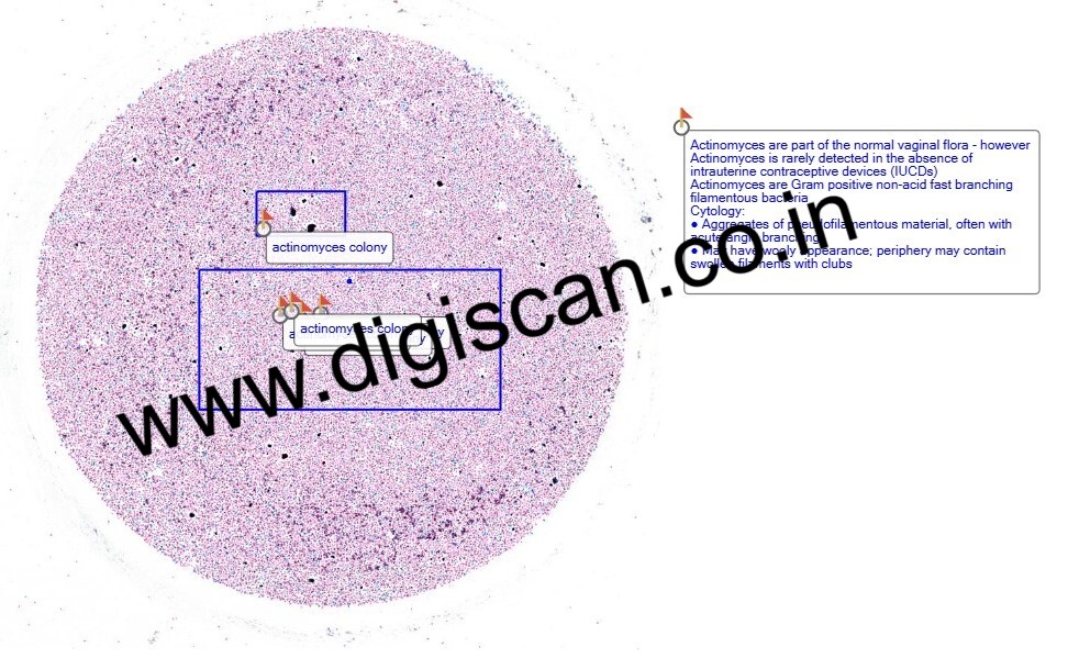 Cervical Cytology (Gynaecological Cytology) Digital Slides Set