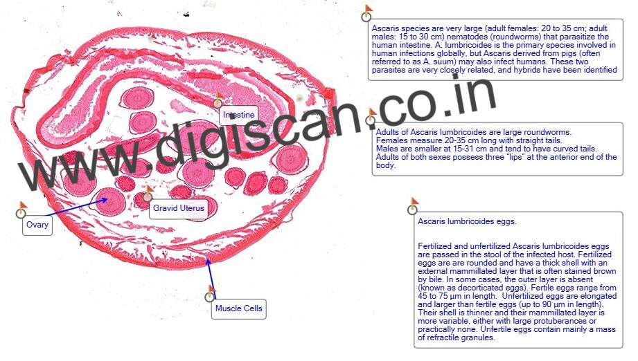 Microbiology & Parasitology Digital Slides Set (Microbial & Parasitic Diseases)