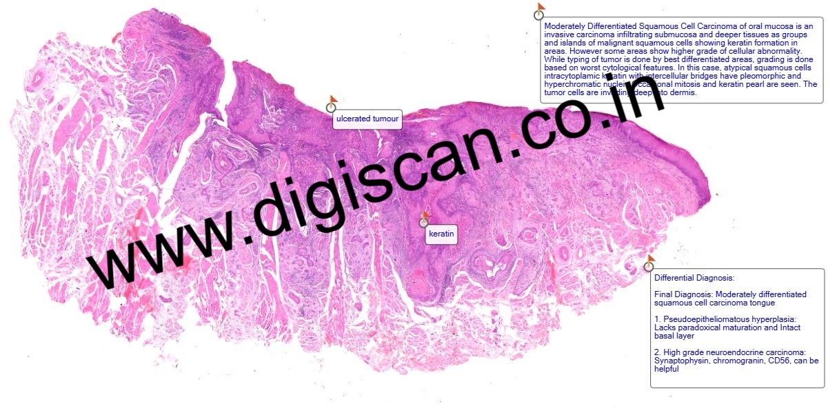 MD Pathology Exam Cases (Digital Slides & Spot Diagnosis Cases)