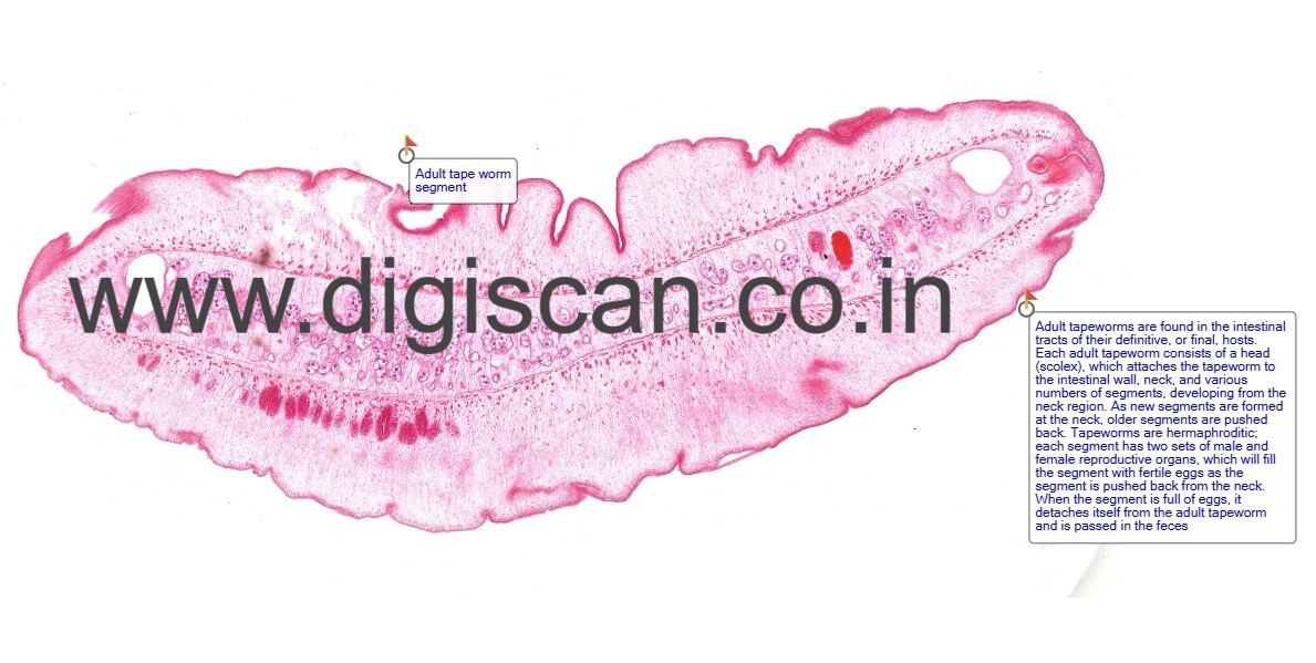 Microbiology & Parasitology Digital Slides Set (Microbial & Parasitic Diseases)