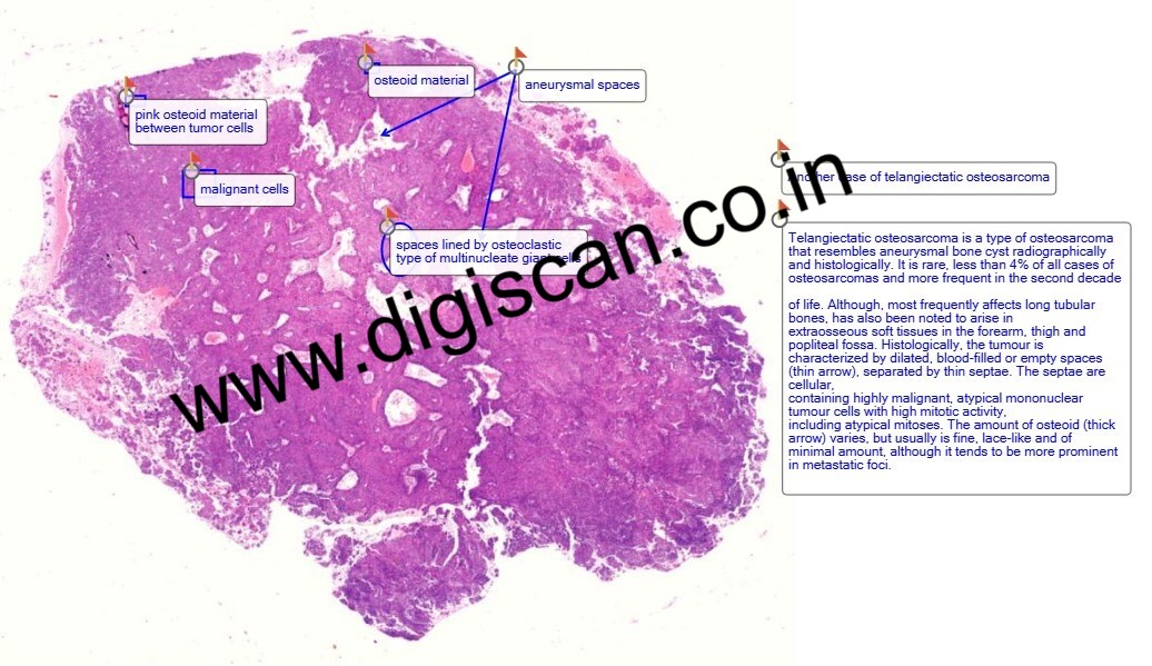 MBBS Pathology Lecture Videos (Basic & Practical Pathology)