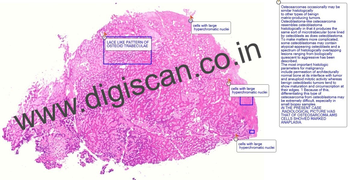 Introduction to Histopathology and Molecular Pathology – Lecture Videos for MD/DNB Students
